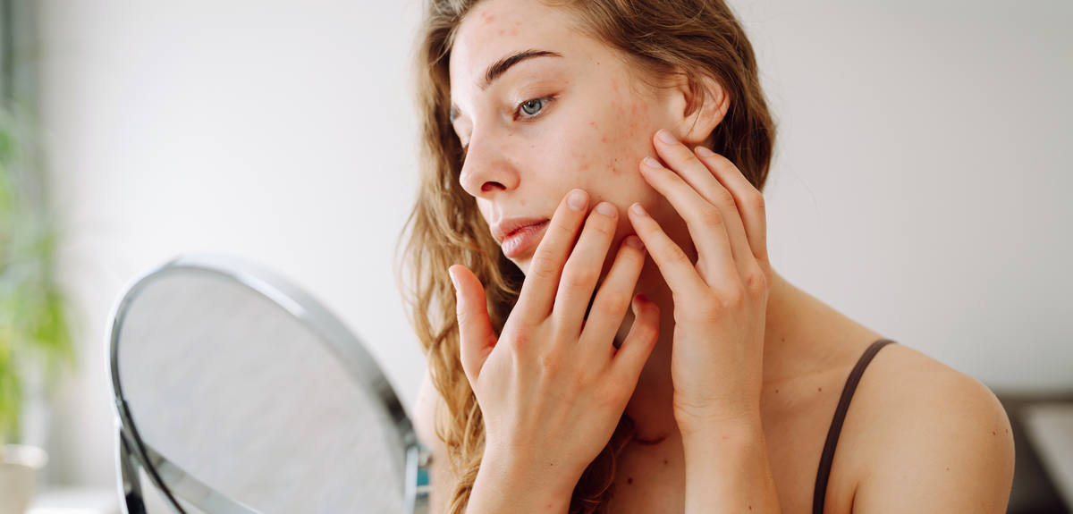 Sensitive Skin