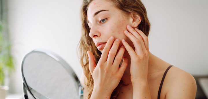 Sensitive Skin
