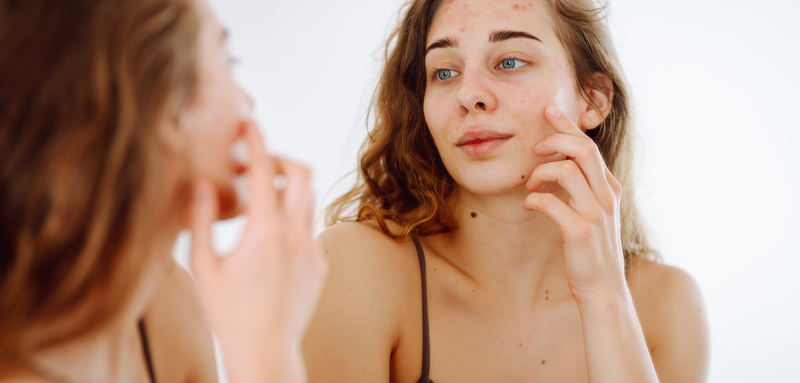 Skin Care Routine for Dry Skin
